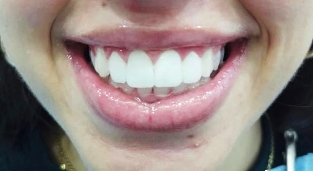 GargomDental_QuienesSomos_ProtesisDentales_Sonrisa