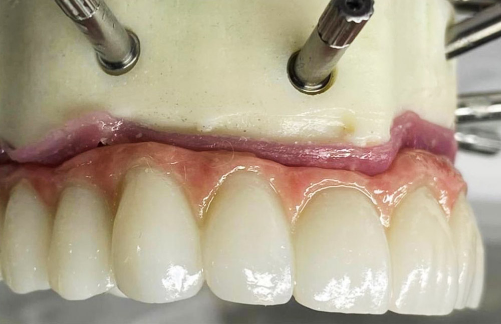 Gargom_Dental_Quienes somos- Laboratorio dental