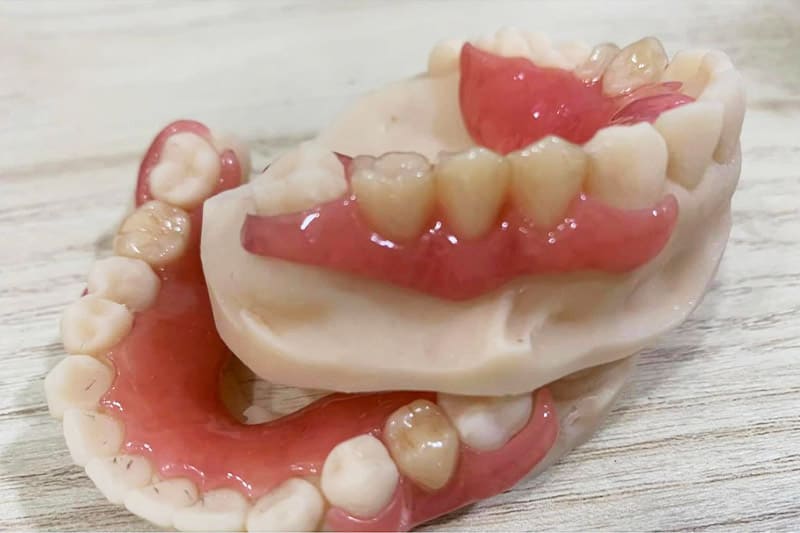 Protesis-Dental-GargomDental-Laboratorios_-2 Prótesis dentales - para restaurar la sonrisa de tus clientes